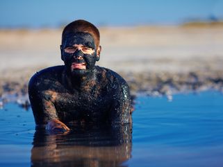 Eczema and Psoriasis